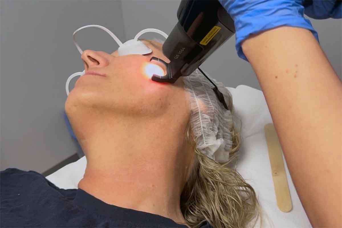 Alma Harmony Aesthetic Treatment
