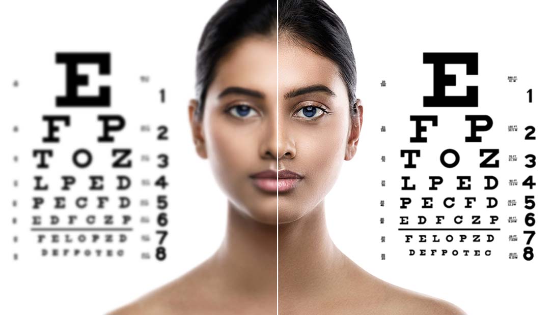 Improved Eye Site with Lasik Improved Eye Site with Lasik